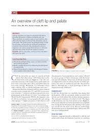 pdf an overview of cleft lip and palat