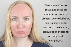 how to cure redness on face 6 home