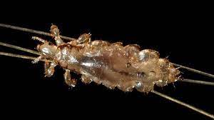 what is head lice symptoms causes