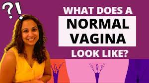 What does a NORMAL vagina look like? | Answers Dr. Niveditha Manokaran -  YouTube