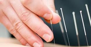 Requirements for becoming a licensed acupuncturist a speech language pathologist specializes in providing nonmedical evaluations and diagnoses of communicative disorders. The 10 Best Acupuncturists In El Paso Tx With Free Estimates