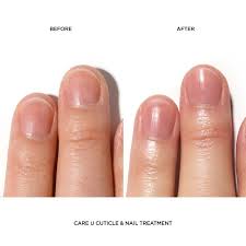 care u cuticle nail treatment 01