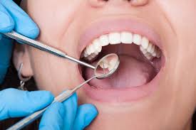 how long does a teeth cleaning take