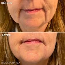 how to treat ageing sad mouth doctor