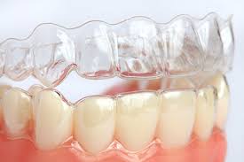 Unlike braces which are permanently fixed on your teeth, you can remove the aligners every now and then without struggling. Want Straighter Teeth Without Braces Invisalign Offers Convenience Visalia Care Dental Visalia California