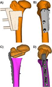 journal of orthopaedic surgery and