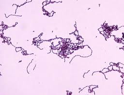 Streptocococcus pyogenes - Infectious Disease Advisor