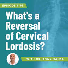 reversal of cervical lordosis