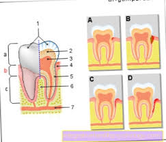 Ako zub boli da dodir jezikom i zagriz onda je najverovatnije u pitanju pariapikalni parodontitis zapravo zub je mrtav ali vas ne boli zub nego vas boli kost iznad zuba. Bol U Vratu Zuba Stomatologija Line