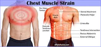 As noted above, the pain associated with. Chest Muscle Strain Causes Symptoms Treatment Recovery Period