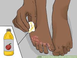 5 home remes to get rid of smelly feet