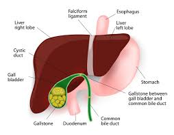 gallbladder disease risks treatments