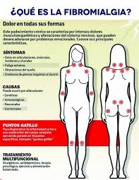 It is more common in women than men, who may experience this and other symptoms differently. Fibromialgia Esa Rara Y Oscura Enfermedad Que Nadie Ve Ibero 90 9
