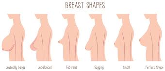 Image result for breast operation