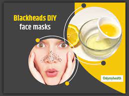 try these 6 amazing diy face masks to