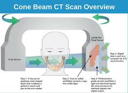 cone beam ct dental scan glendale