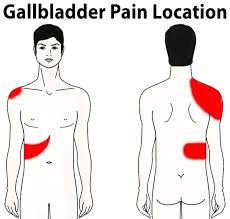 best gall bladder stone treatment in