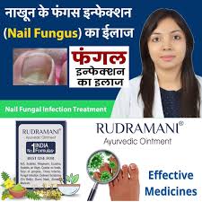 nail fungal infection ointment at rs