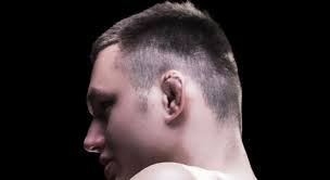 Now what i mean by cauliflower ear is when the ear becomes deformed, sometimes beyond recognition. Cauliflower Ear Repair