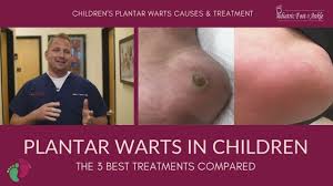 children s plantar warts treatment