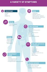 Learn causes, symptoms and treatments. Lupus A Rare Disease That Affects Women Servier