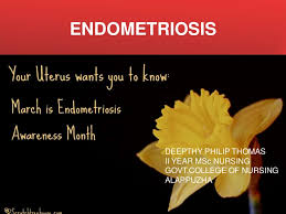 Theories in endometriosis, sites of endometriosis. Endometriosis