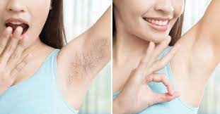 underarm hair removal tips in hindi