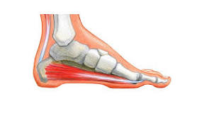 Image result for icd 10 code for calcaneal bone spur
