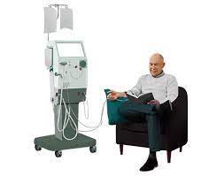 home haemodialysis therapy exle site