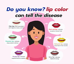 can lip color tell the disease