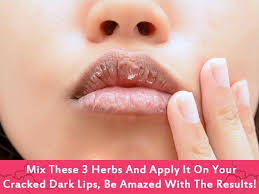 dark lips