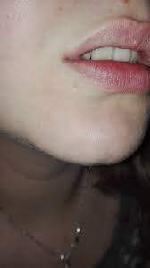 lip pierced at 16 i did it on my own