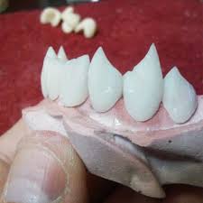 They have huge canine teeth. This Guy Is Proving 70 Custom Vampire Fangs Aren T Just For Halloween Anymore Inc Com