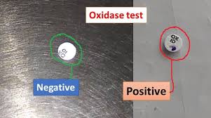 oxidase test for bacteria introduction