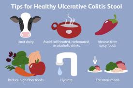 ulcerative colitis stool why your