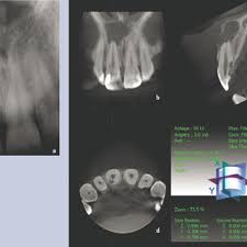 pdf cone beam ct in dental practice