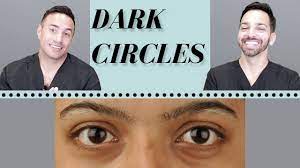 dark circles causes treatments