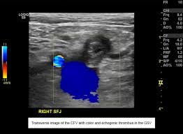 Case Studies Featuring the Use of Therapeutic Ultrasound and     OBGYN Net Case Study       Poor Performance