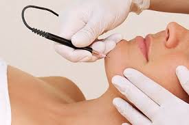 electrolysis hair removal everything