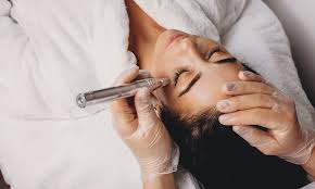 what is microdermabrasion the gist