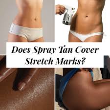 does spray tan cover stretch marks