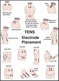 Tens Unit Electrode Placement Guide Prohealthcareproducts Com