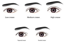dst double eyelid surgery the