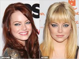 Red hair has a lot more red pigment than ashier, colder tones. Emma Stone Is Blonde Again The Science Of Hair Dyes Orange County Hair Restoration Center