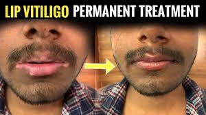 lip vigo treatment organic