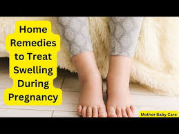 treat swelling during pregnancy