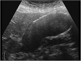 Abdominal ultrasound case study   Custom Writing at     WK   WES SIGN Abdomen and retroperitoneum       Gallbladder and bile ducts    Case    