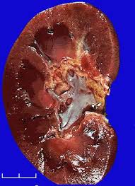 Image result for kidney
