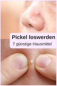 In a small saucepan, combine water, vinegar, and salt. Pickel Loswerden Pickel Hausmittel Pickel Soforthilfe Pickel Entfernen Pickel Tee Home Remedies For Pimples How To Remove Pimples How To Get Rid Of Pimples