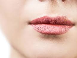 white ps on lips causes treatments
